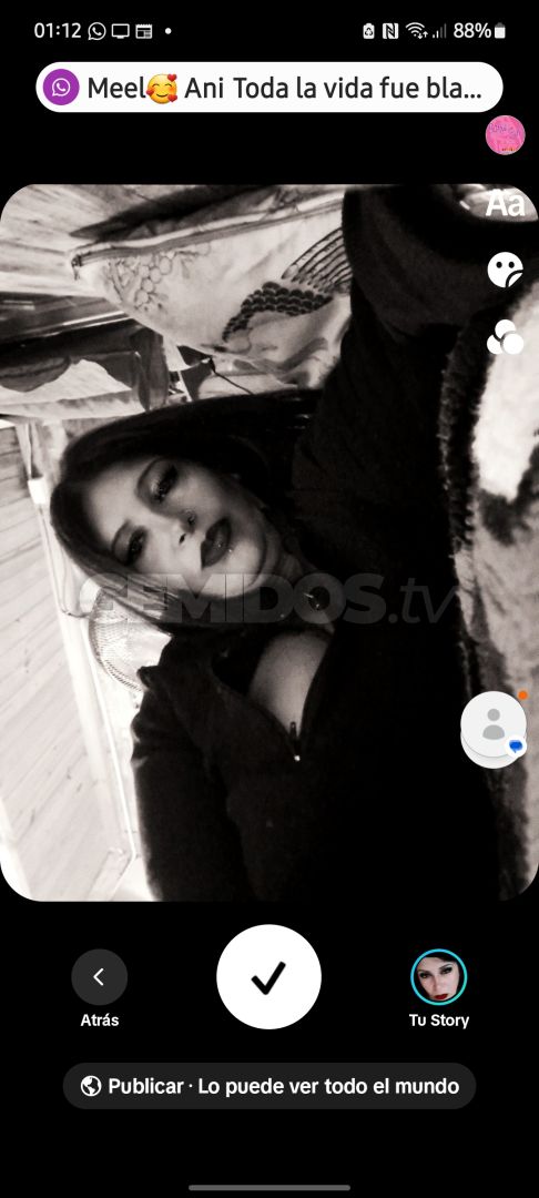 Noe ZS